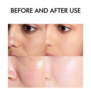 Suero Facial con Ácido Hialurónico y Vitamina C, Iluminador, Revitalizante, Mejora la Luminosidad de la Piel, Suero Facial para el Cuidado de la Piel, OEM ODM - Product Image 6