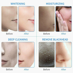 Spa Use Skin Rejuvenation Facial Care Machine Face Lift Beauty Equipment - Product Image 5