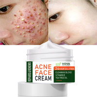 Aceite de árbol de té de hierbas blanqueador orgánico, tratamiento de punto de acné, eliminación de acné, crema facial, el mejor de 2021