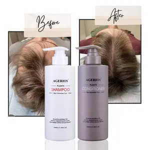 Agerios Anti-Hair Loss Treatment Sulfate Freeシャンプー男性と女性のためのビオチンシャンプーすべての髪のタイプのヘアコンディショナー