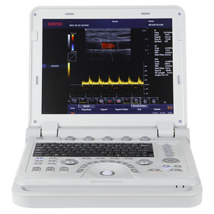 CONTEC CMS1700B sonde linéaire bébé machine à ultrasons chine machine à ultrasons pour la grossesse - Product Image 2