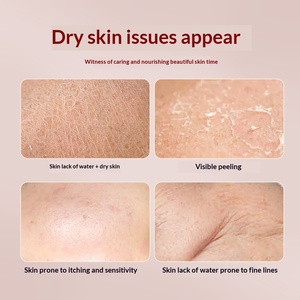 Natural Plant <strong>Essential</strong> <strong>Oil</strong> Rose Ginger Lavender Wormwood HODAF Brand ISO Certified 1 Year Shelf Life Soothe Dry Skin Soft - Product Image 5