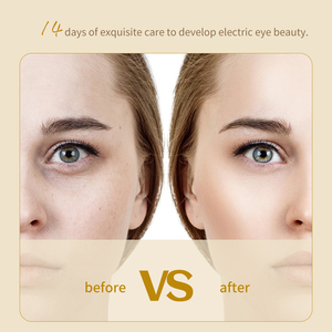Crema Vegana Anti-Hinchazón para Ojos al por Mayor en Línea con Ácido Hialurónico y Vitamina C Natural para Hidratar las Ojeras y Bolsas de los Ojos - Product Image 5