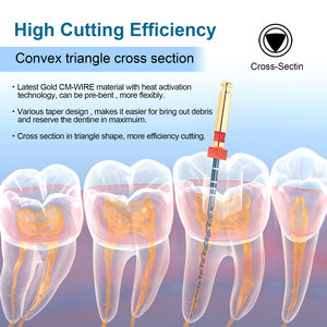 S1 #21mm di alta qualità dentale <span class=keywords><strong>Endo</strong></span> <span class=keywords><strong>file</strong></span> blu rotanti materiale Niti viola anello strumento dentista per il trattamento canalare - Product Image 4
