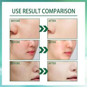 เจย์ซูอิง 30 มล. เอสเซนส์วิตามินบี5 ลดเลือนริ้วรอย บำรุงผิวให้ชุ่มชื้น กระจ่างใส เรียบเนียน ฟื้นฟูผิว เซรั่มบำรุงผิวหน้าวิตามินบี5 - Product Image 6