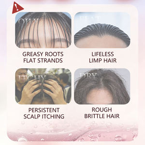 Champú en Barra con Aroma a Rosas OEM/ODM para un Cabello Suave y Refrescante, con Limpieza Suave y Fragancia Duradera - Product Image 4