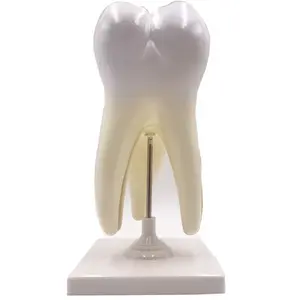 Gelsonlab HSDT-3353-2 Triple Root Molar with Caries Model, Enlarged 15 Times, 2 Parts, Hand Painted