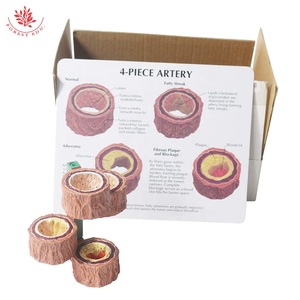 Modelos anatómicos Endurecimiento humano de la arteriosclerosis Modelo de 4 piezas para demostración de enfermedades vasculares Herramienta de enseñanza médica - Product Image 6