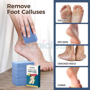 حجر خفاف بمقابض لإزالة مسامير القدم (الجلد الميت) - منتجات OEM - Product Image 5