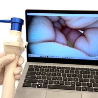 Laryngoscope vidéo flexible USB Sensorendo, bronchoscope jetable, rhinolaryngoscope ORL, kit d'intubation pour ordinateur portable, téléphone, tablette