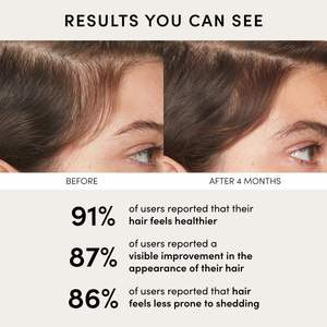 เซรั่มบำรุงหนังศีรษะสูตรออร์แกนิค ลดรังแค ปรับสมดุลเส้นผม สารสกัดจากโคลเวอร์แดง สารสกัดจากโสมไซบีเรีย เปปไทด์ ช่วยให้หนังศีรษะดูหนาขึ้น ดูอิ่มฟูขึ้น - Product Image 6