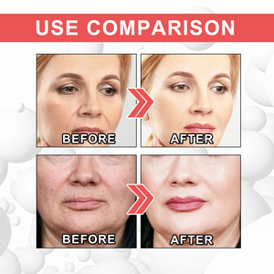 Atacado <span class=keywords><strong>Anti</strong></span>-Envelhecimento Face Soro Whitening Colágeno <span class=keywords><strong>Boost</strong></span> <span class=keywords><strong>Anti</strong></span>-Rugas Líquido Lutas Dilui e manchas pretas - Product Image 5