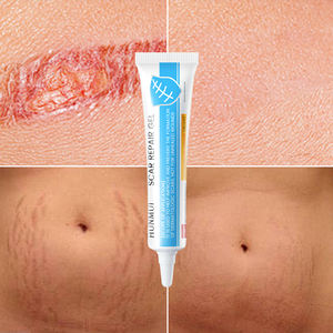 OEM ODM Private Label Bauch narben entfernungs creme mit Silikonentferner-Gel-Dehnung streifen creme für die Behandlung von Gesichts bauch narben - Product Image 5