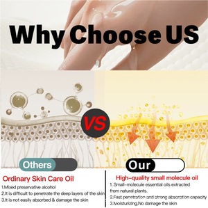 <span class=keywords><strong>Huile</strong></span> essentielle <span class=keywords><strong>de</strong></span> 1000 ml, 100 % pure, distillée à la vapeur, pour la perte <span class=keywords><strong>de</strong></span> poids, brûleur <span class=keywords><strong>de</strong></span> graisse, extraits <span class=keywords><strong>de</strong></span> lavande, curcuma, gingembre, <span class=keywords><strong>rose</strong></span>, pour femmes - Product Image 4