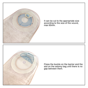 Fournitures de stomie 15mm-60mm Pochette drainable monobloc pour les soins de stomie par lériostomie - Product Image 5