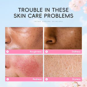 <span class=keywords><strong>DR</strong></span>.ROSEVA 100mL Sakura cuidado de la piel tóner forma líquida calmante blanqueamiento brillo hidratante tóner - Product Image 3