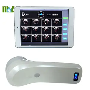 Portable Apple iOS Android 4D Wireless Bladder Scanner in stock MSLPU37