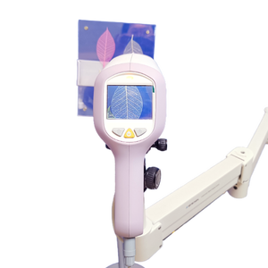 أحدث كاميرا فيديو إلكترونية محمولة من نواة المهبل منظار المهبل بالفيديو لأمراض النساء - Product Image 5