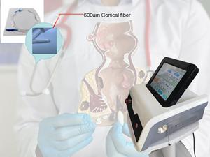 เครื่องเลเซอร์รักษาโรคริดสีดวงทวาร LHP 50W 980nm 1470nm แบบไดโอด สำหรับรักษาโรคริดสีดวงทวาร รูรั่ว ร่องแผล ริดสีดวงทวาร โรคทางทวารหนัก และการผ่าตัด - Product Image 2