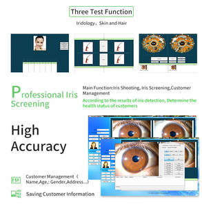 새로운 1200만 화소 USB 눈 진단 아이리스코프 좌우 램프 아이리스코프 아이리돌로지 카메라 눈 홍채 분석기 - Product Image 6