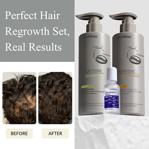 Set per la Crescita Naturale dei <span class=keywords><strong>Capelli</strong></span> a Marchio Privato: Siero Roll-On e <span class=keywords><strong>Spray</strong></span> Bloccante DHT, Shampoo e Balsamo per il Trattamento del Cuoio Capelluto e la Ricrescita dei <span class=keywords><strong>Capelli</strong></span> - Product Image 1
