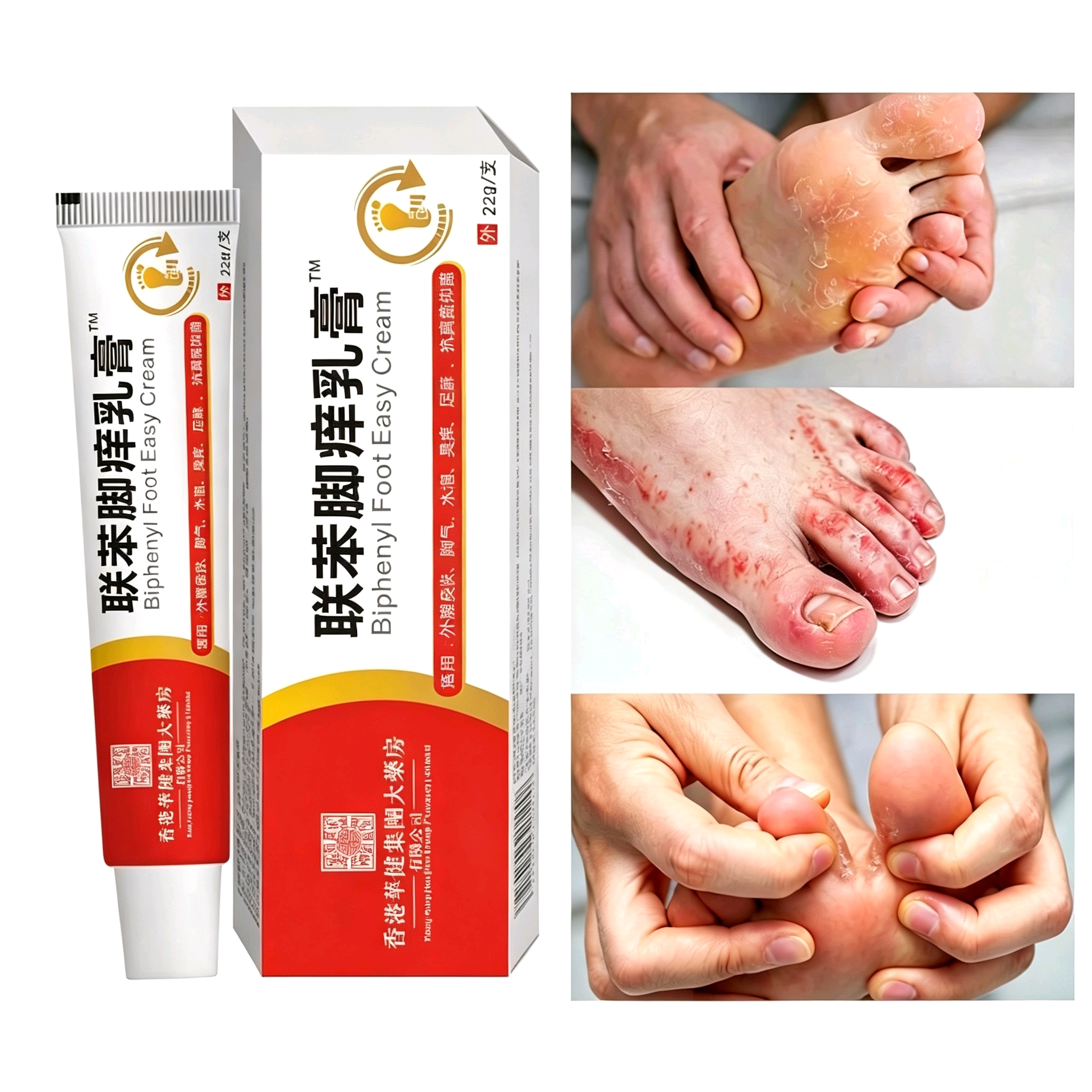 [Powerful Antibacterial] 22g Athlete's Foot Ointment - Rapid Itch Relief & Fungal Defense for Peeling, Blisters & Foot Health