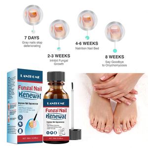 <span class=keywords><strong>Meilleur</strong></span> <span class=keywords><strong>traitement</strong></span> contre les infections fongiques, remèdes Lanthome pour la réparation des ongles fongiques - Product Image 5