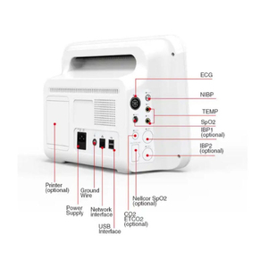 Système de surveillance portable professionnel pour soins intensifs (CCU) - ECG, NIBP, SpO2, température - Moniteur portable vétérinaire pour cliniques animales - Product Image 6