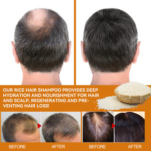 แชมพูสระผมที่มีความหนาแน่นสูงแชมพูโออีดียี่ห้อส่วนตัวทำความสะอาดเส้นผมอย่างล้ำลึกให้ความชุ่มชื้นกับรากผมและแก้ไขผลิตภัณฑ์ดูแลเส้นผม - Product Image 2