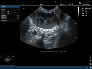 Système d'échographie vétérinaire portable durable SONOIMAGE N38 certifié CE Classe II pour le contrôle du rythme cardiaque fœtal, ECG en option - Product Image 5