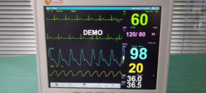 เครื่องวัดสัญญาณชีพทางการแพทย์และสัตวแพทย์ หน้าจอเต็มขนาด 12 นิ้ว  6 พารามิเตอร์ - Product Image 4