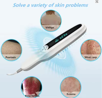 Appareil de photothérapie portable pour usage domestique, lampe UVB 311nm pour le traitement du psoriasis et du vitiligo, crème de soin de la peau, dispositif 308nm