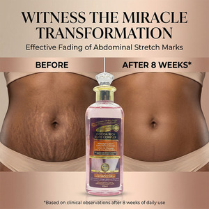 Minyak Tubuh Gluta Master Stretch Mark Formula Alami Bernutrisi Melembapkan Secara Mendalam Meningkatkan Elastisitas Memudarkan Bekas Kehamilan 200ml - Product Image 1