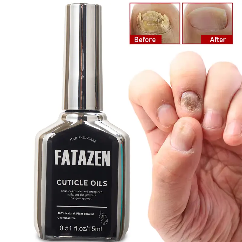 Großhandel Nagelpflege Verhindert Nagelwachstumsbehandlung Nagelzuchtöl OEM Ernährung Revitalisator Peelingentferner Nagelwachstumsöl