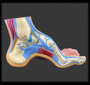 Pied plat de pied normal <span class=keywords><strong>humain</strong></span> et modèle de pathologie d'anatomie du pied arqué 3PCS - Product Image 5
