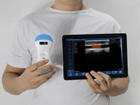3 en 1 Wifi Función Color Doppler Convex Phased Array Sonda lineal Sistema de diagnóstico de ultrasonido inalámbrico