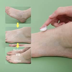 Main orange de vitamine E de citron blanchissant apaisant éclaircissant la crème et la lotion de <span class=keywords><strong>pieds</strong></span> personnalisées - Product Image 5