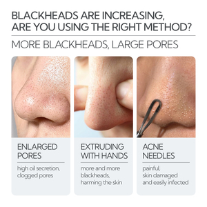 Lanbena - Nuevo Set para Eliminar Puntos Negros, Parche Nasal, Suero Reductor de Poros y Tiras para Poros Nasales 30g y 30ml - Product Image 3