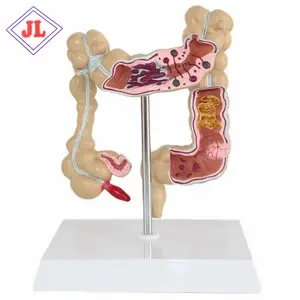 Material médico avançado, ensino humano, modelo de anatomia do intestino grande para a escola e hospital