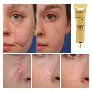 Sérum et Crème pour l'Élimination des Cicatrices d'Acné, des Boutons et des Vergetures à Base de Plantes, Convient à Tous les Types de Peau - Product Image 2