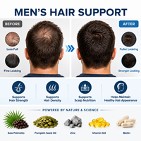 Capsule de complément alimentaire pour la croissance des cheveux pour hommes OEM ODM avec du palmier nain, de l'huile de graines de citrouille, du zinc, de la vitamine D3 et de la biotine pour la force des cheveux