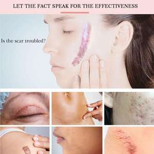 흉터 조직 연화, 여드름 자국 제거, 거친 피부 매끄럽게 하는 데 효과적인 라벤더 흉터 개선 크림 - Product Image 5