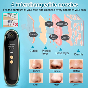 <span class=keywords><strong>Appareil</strong></span> d'aspiration visuelle des points noirs, <span class=keywords><strong>appareil</strong></span> de nettoyage des <span class=keywords><strong>pores</strong></span> <span class=keywords><strong>du</strong></span> <span class=keywords><strong>visage</strong></span>, <span class=keywords><strong>appareil</strong></span> électrique portable <span class=keywords><strong>pour</strong></span> l'élimination des points noirs et des micro-bulles - Product Image 4