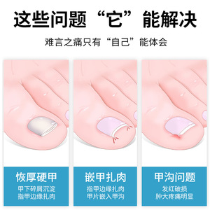 ชุดอุปกรณ์ทำเล็บเท้าสแตนเลสแบบปากนกอินทรี สำหรับตัดเล็บขบ ใช้ในบ้าน พกพาสะดวก สำหรับผู้ใหญ่ - Product Image 3