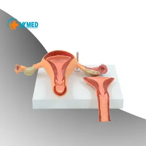 厂家直销解剖模型医学科学生殖结构妇科正常子宫模型