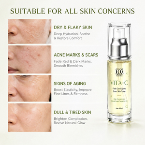 Suero de Vitamina C de Marca Privada con Resultados en 7 Días, 5% Niacinamida, Antiarrugas, Antienvejecimiento, Exfoliante, Corrector de Manchas Oscuras para el Rostro - Product Image 4