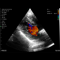 Sonda de Ultrasonido Inalámbrica 3 en 1 JM-5CPL, Escáner Portátil Doppler a Color, Sonda Convexa, Lineal y de Fase, para Uso Médico y Veterinario