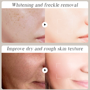 Nhãn Hiệu Riêng 120G Vitamin C Kojic Axit Collagen Giữ Ẩm 7 Ngày Nhanh Chóng Làm Trắng Da Mặt Kem Làm Trắng Kem - Product Image 5