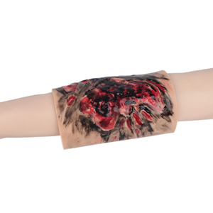 Modèle de simulation réaliste de brûlures <span class=keywords><strong>des</strong></span> membres DARHMMY BOU/CS-3, degré 3-4, pour <span class=keywords><strong>la</strong></span> <span class=keywords><strong>formation</strong></span> aux soins <span class=keywords><strong>des</strong></span> brûlures - Product Image 3