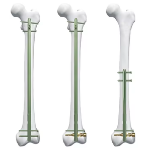 Tornillo de Bloqueo Distal y <span class=keywords><strong>Proximal</strong></span> para Clavo Intramedular de Titanio - Product Image 3